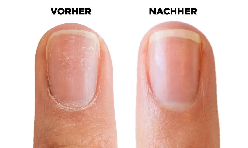 02_Kollektionen/INSIDE Unterschiede/finger.jpg
